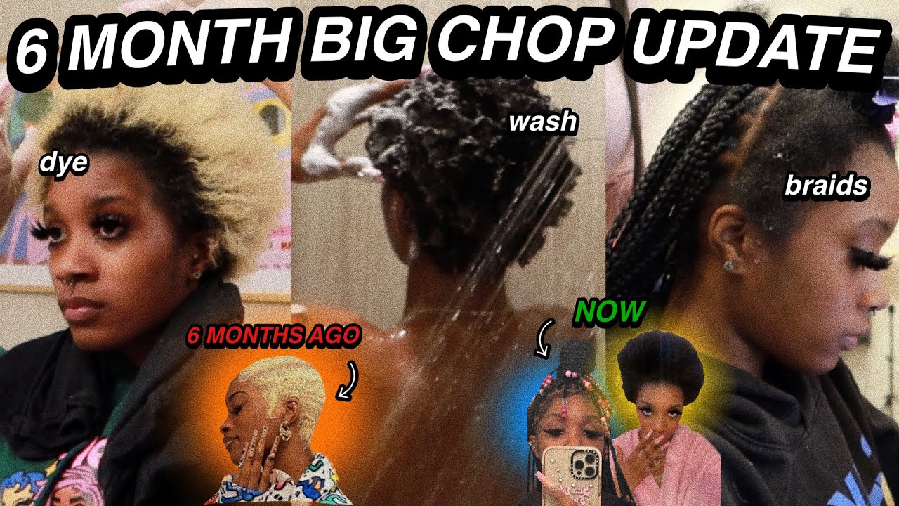 all my hair fell out...6 months ago (BIG CHOP UPDATE + getting braids for the first time) !!!!