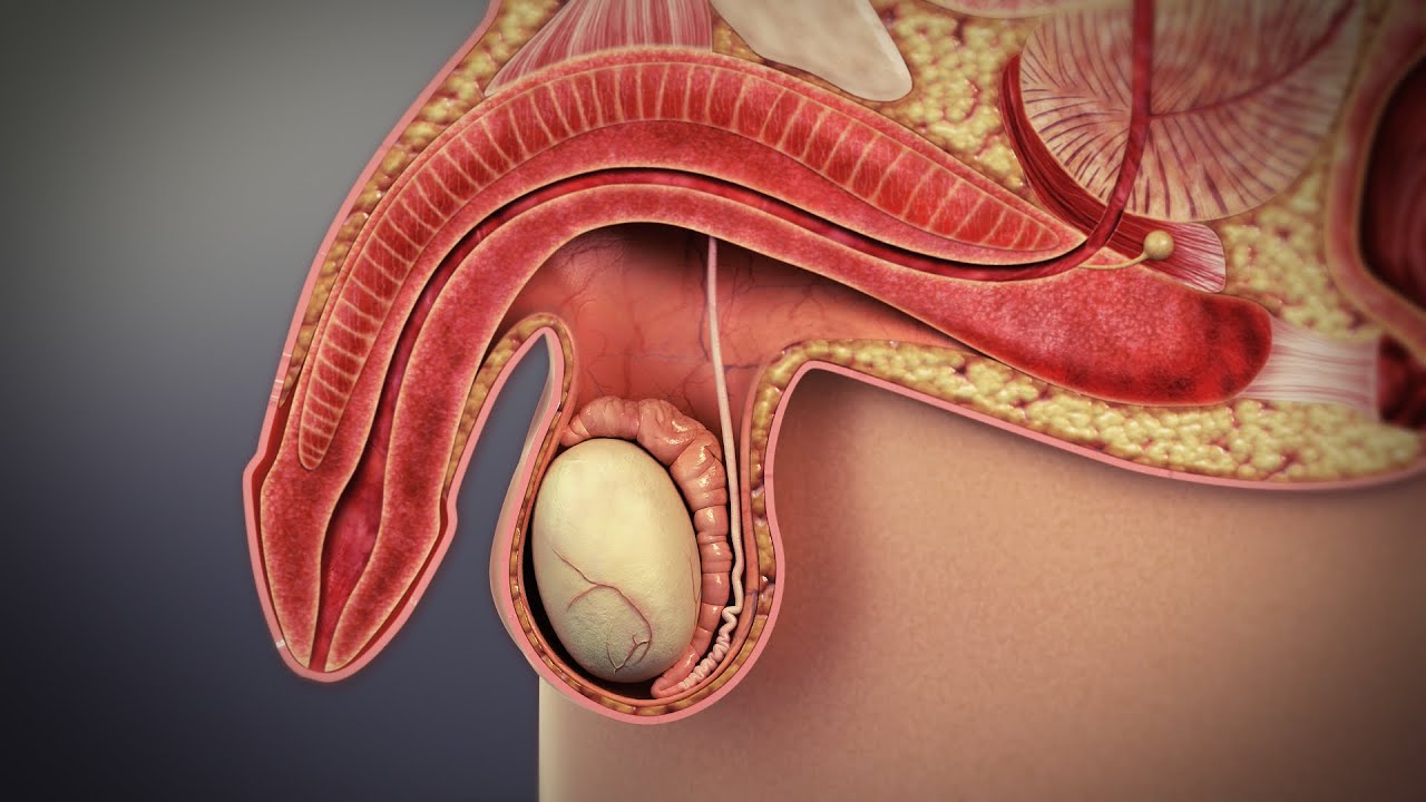Erectile dysfunction || Prof. Mohamed Dyaa Saleem