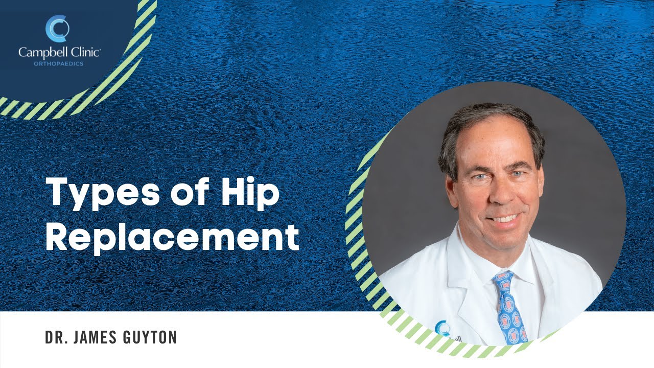 Types of Hip Replacement with Dr. Guyton