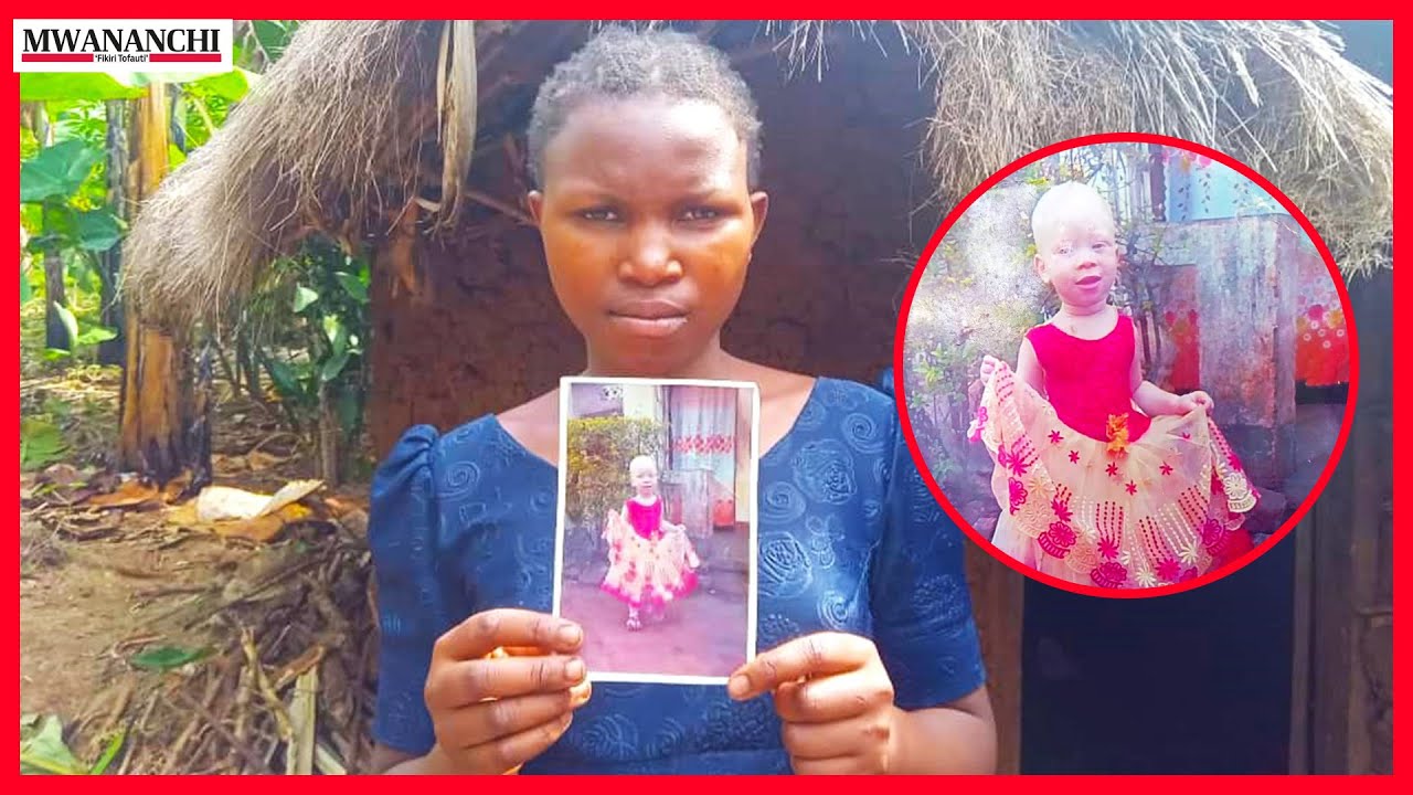 Mama asimulia watu wasiojulikana walivyompora mwanawe mwenye ualbino, baba wa mtoto awekwa kizuizini