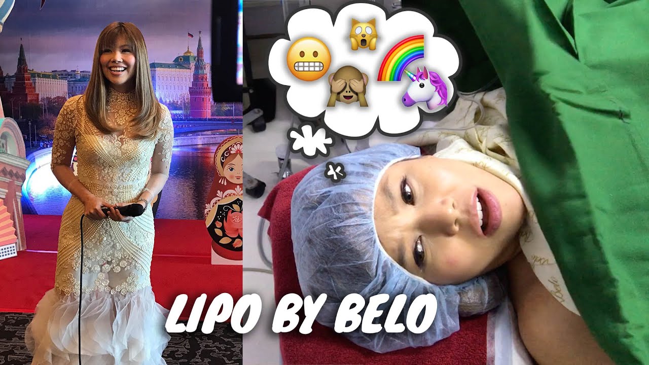 Before & After: My Belo Lipo Transformation | Bianca Valerio