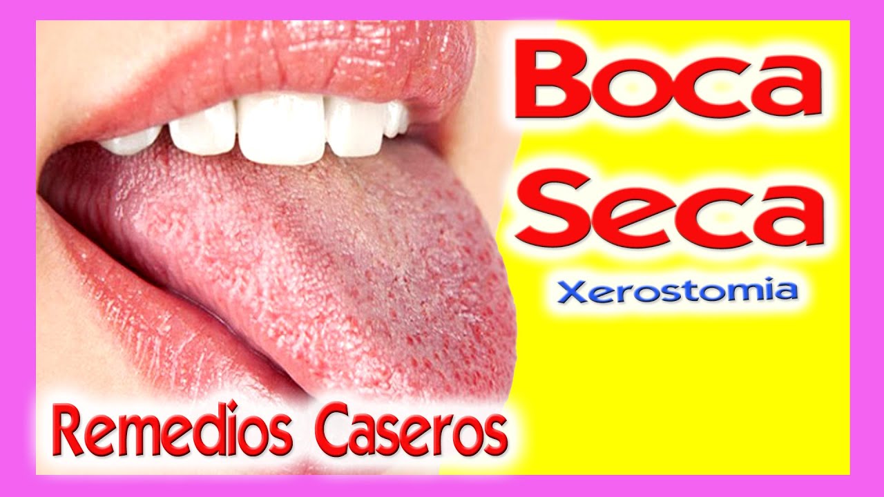 BOCA SECA - MAL ALIENTO (Xerostomia) = TONSILOLITOS / caseum CAUSAS Y SOLUCIONES