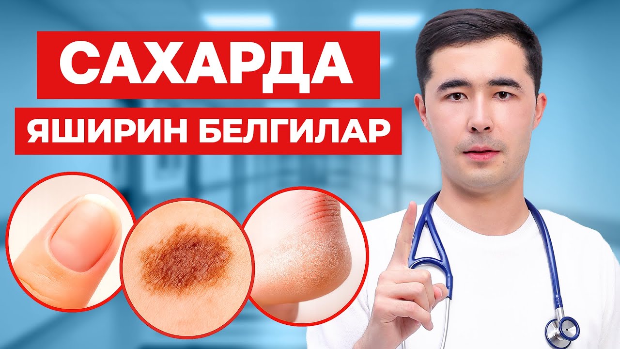 КАНДЛИ ДИАБЕТ ШУНДАЙ БОШЛАНАДИ. САХАФАРДА ЯШИРИН ИЛК БЕЛГИЛАР ВА ДАВОЛАШ