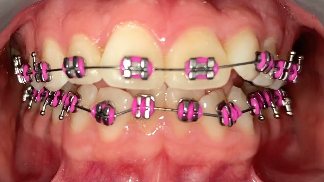 Smile Transformation 04.15.25