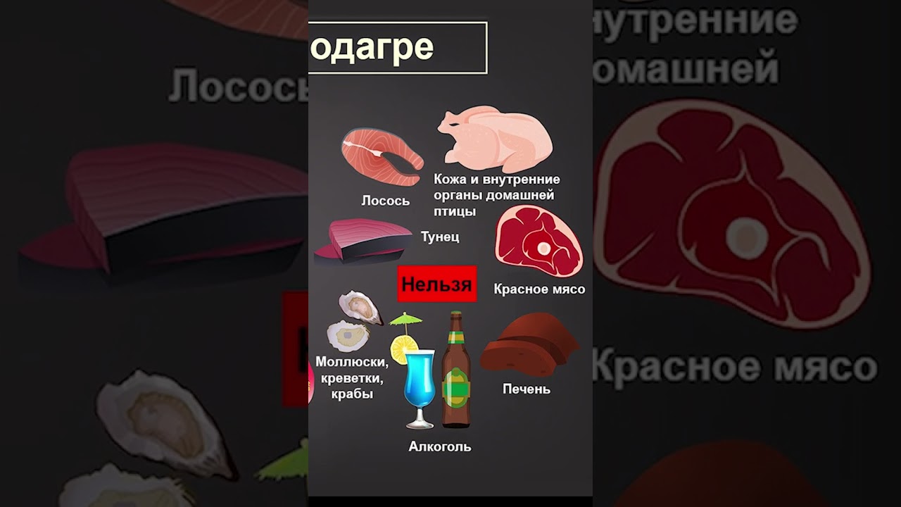 Подагра 🔥 Причины подагры у мужчин и женщин. Что нельзя есть при подагре