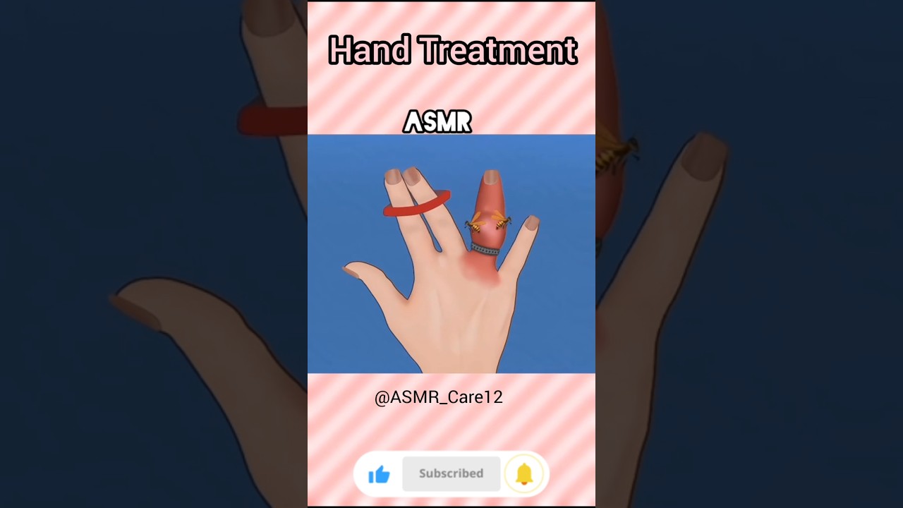 Hand Deep Cleaning | Hand treatment #asmr #animation #satisfying #relax #shorts #shots #short #viral