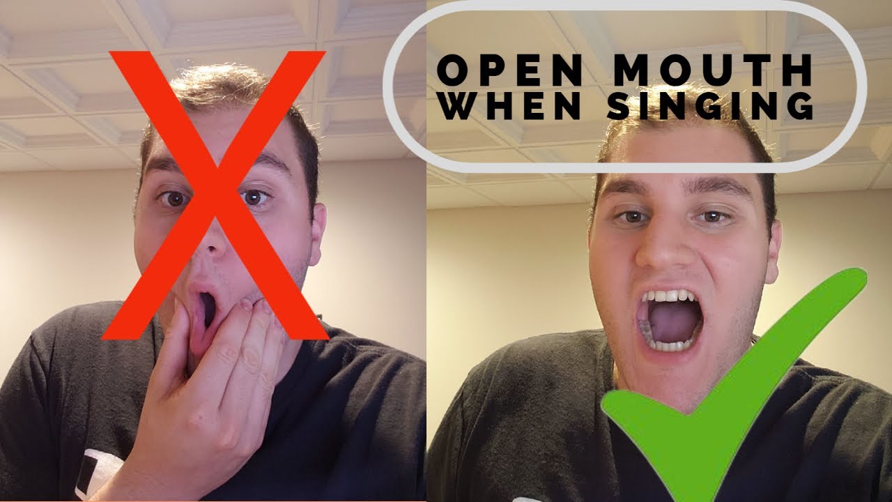 How to Open Your Mouth when Singing: Singing Technique Ep.4
