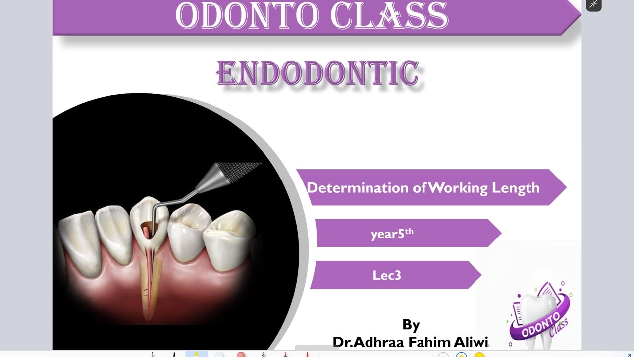 Endodontic.5.lec3. Determination of Working length 