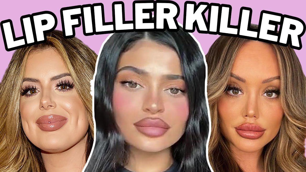lip fillers will ruin you