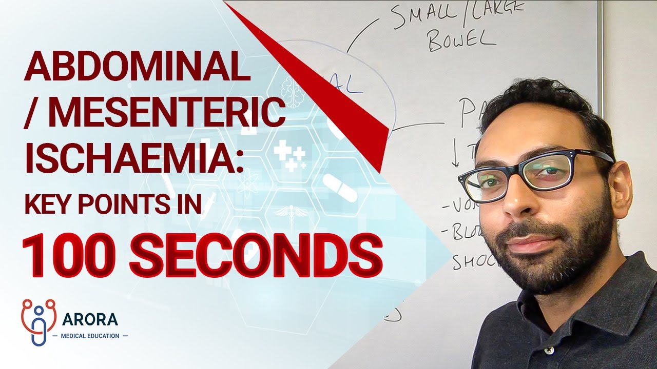 Abdominal / Mesenteric Ischaemia: key points in 100 seconds