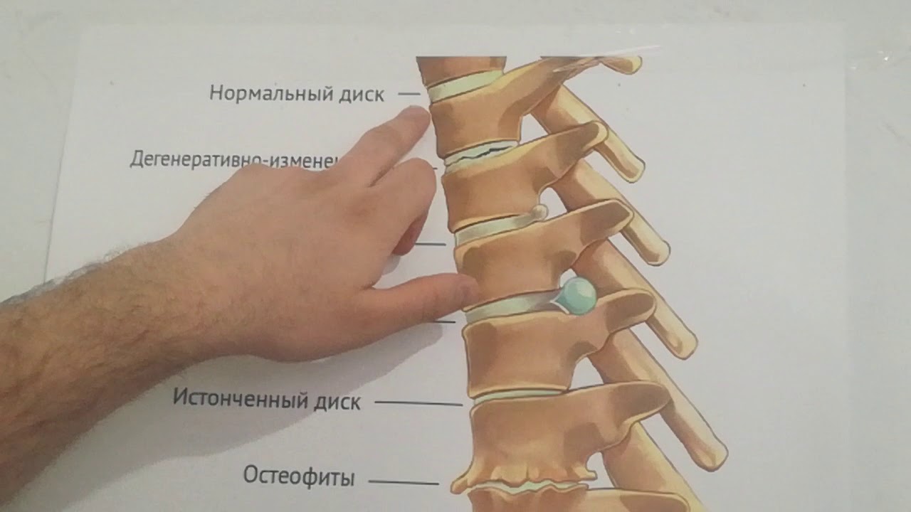 აუცილებელი რჩევები რომელიც უნდა იცოდეთ თქვენი ხერხემლის შესახებ