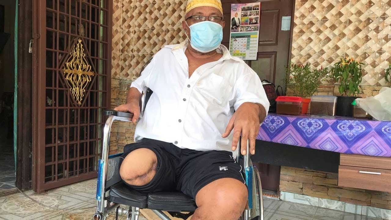 Pasrah teruskan hidup dengan kedua-dua kaki kudung