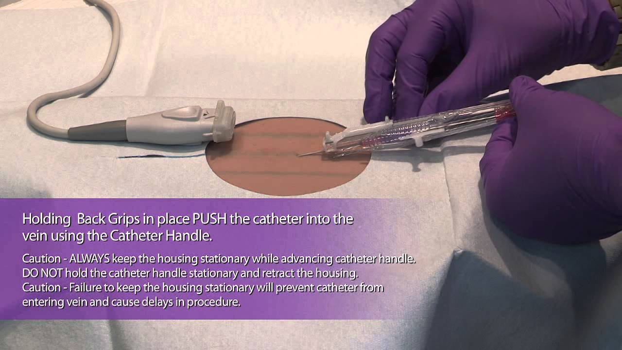 PowerGlide Midline Catheter - MDEA 2013 Bronze Winner