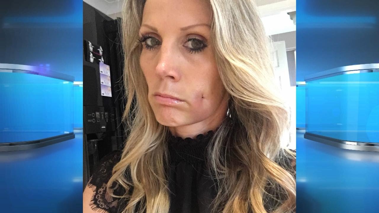 Surgery to Get Dimples?!