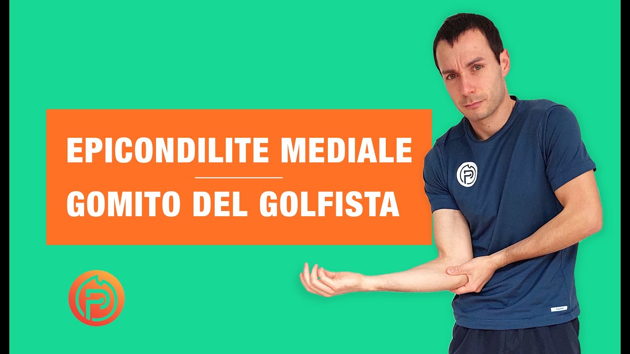 GOMITO del GOLFISTA o TENDINOPATIA dei FLESSORI/PRONATORI di polso, dita e gomito. Cosa fare! (2022)