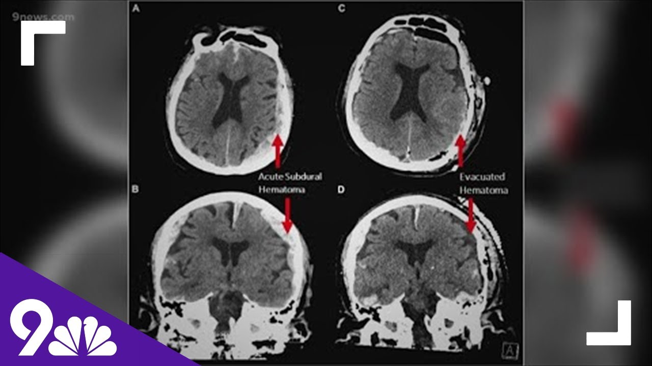 Brain scans reveal secrets of our final moments