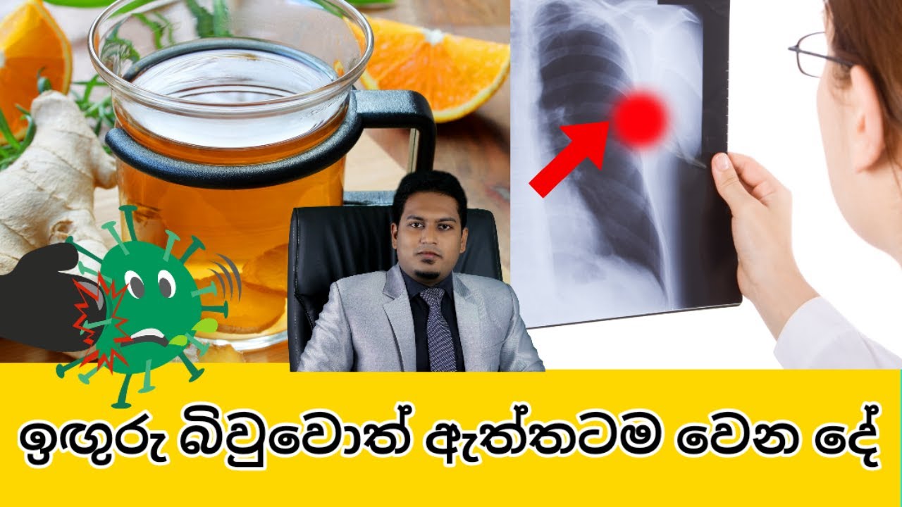 මේව දන්නෙ නැතිවද ඔබත්  Ginger  බොන්නෙ? | Ginger for Health  Issues | Nutritionist Hiroshan Jayaranga