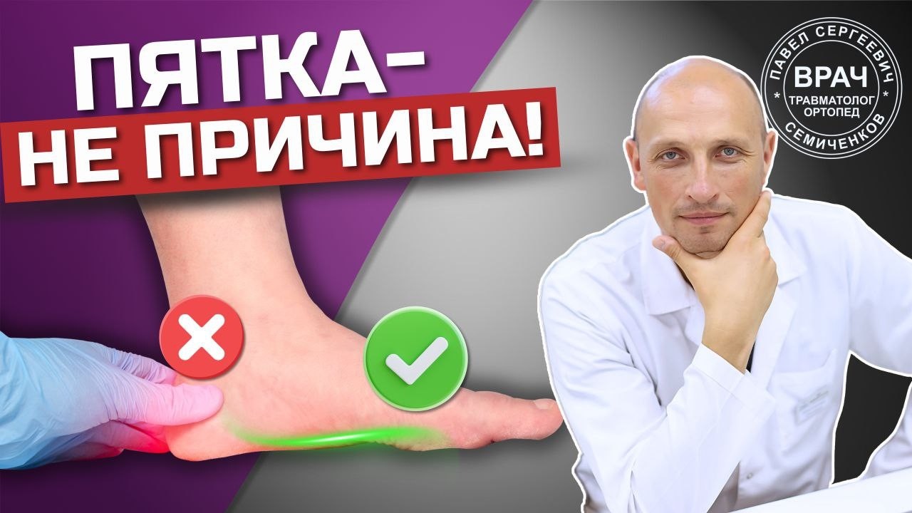 Ортопедическая обувь НЕ лечит вальгус! Вот что действительно работает