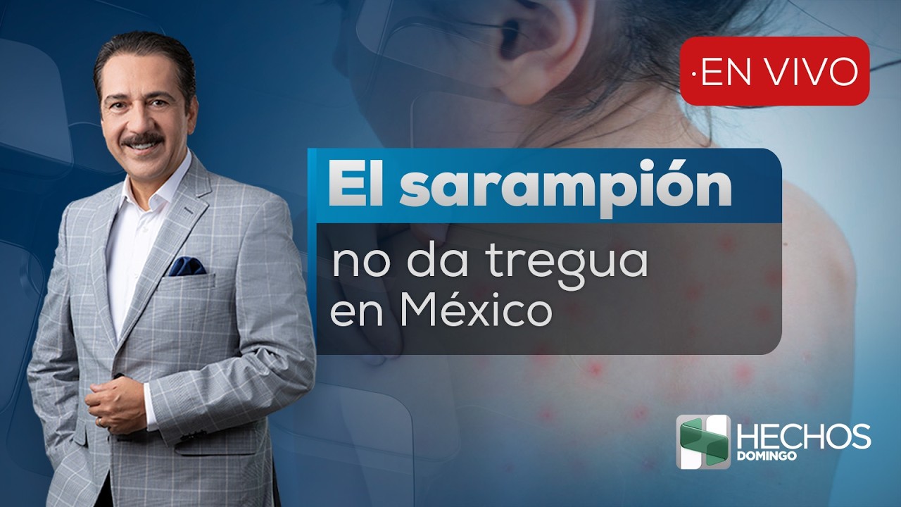 #HechosDomingo | Siguen aumentando los casos de sarampión en el país  (08/02/26)