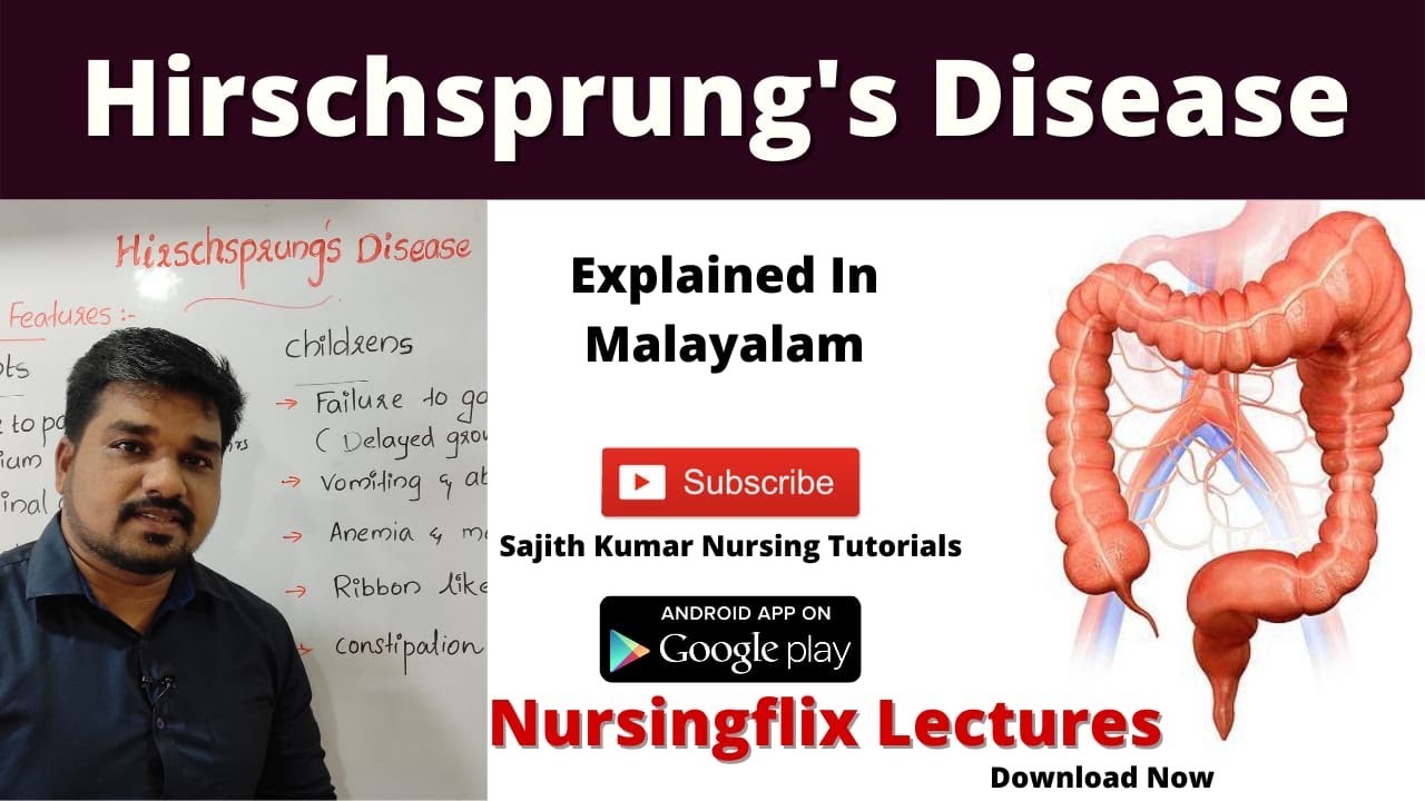 Hirschsprung's Disease- Explained In Malayalam