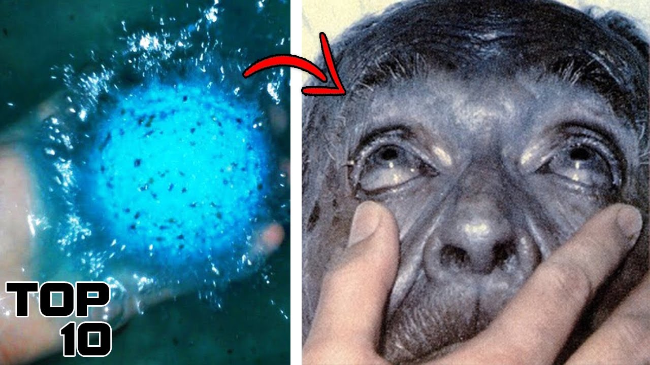 Top 10 Most Toxic Substances In The World