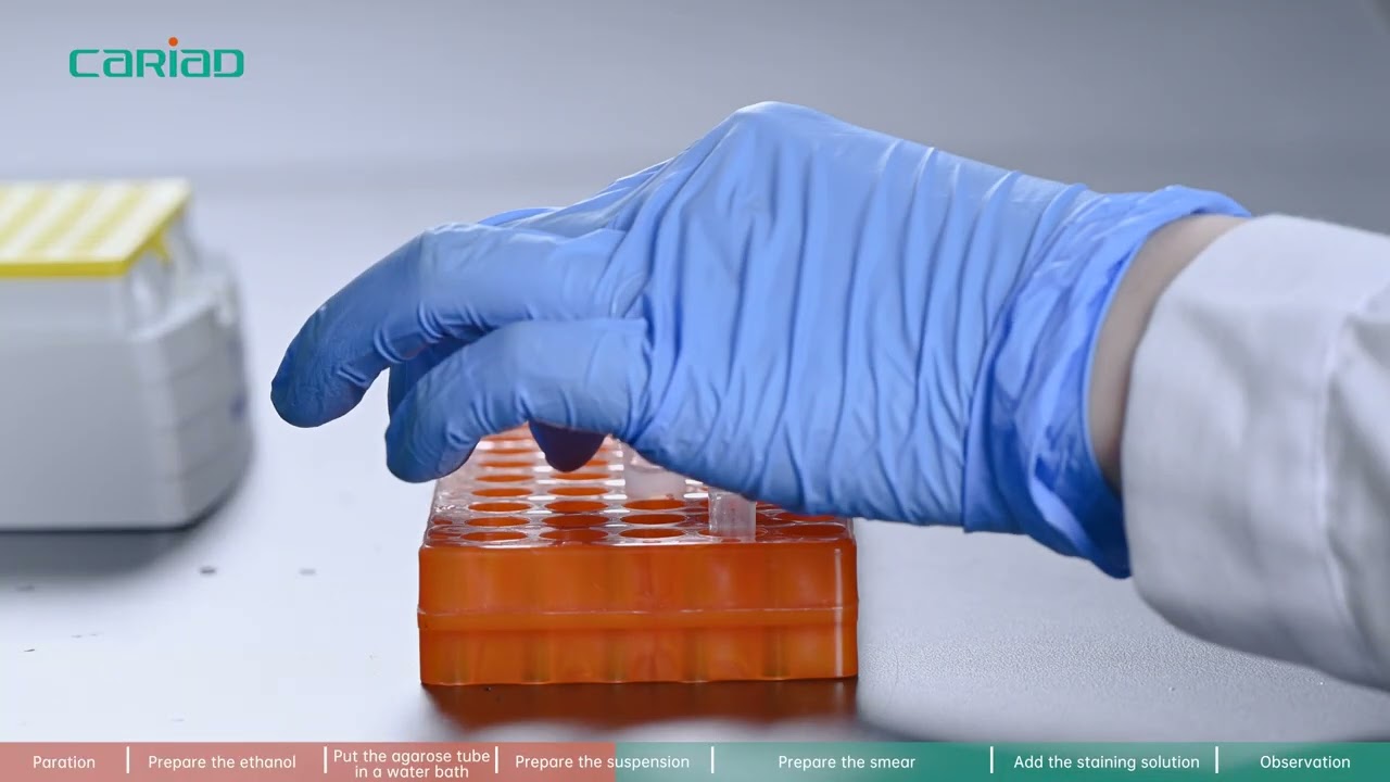 Sperm DNA Fragmentation Detection Kit (Sperm Chromatin Dispersion Method) Version before May 2024