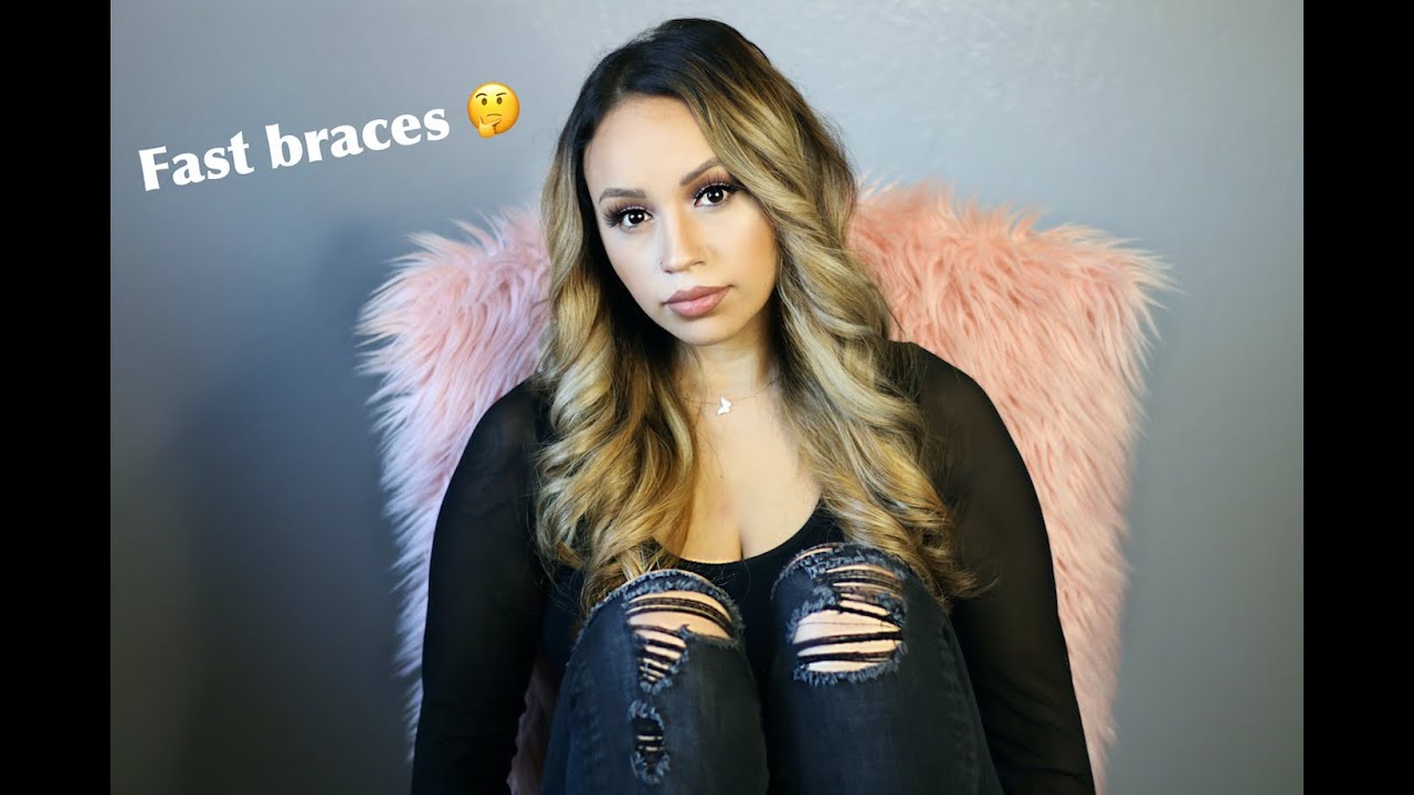 Fast Braces experience