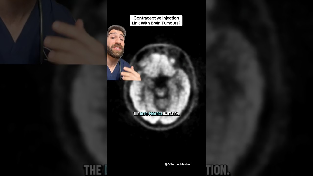 Contraceptive Linked to Brain Tumours? Doctor Explains