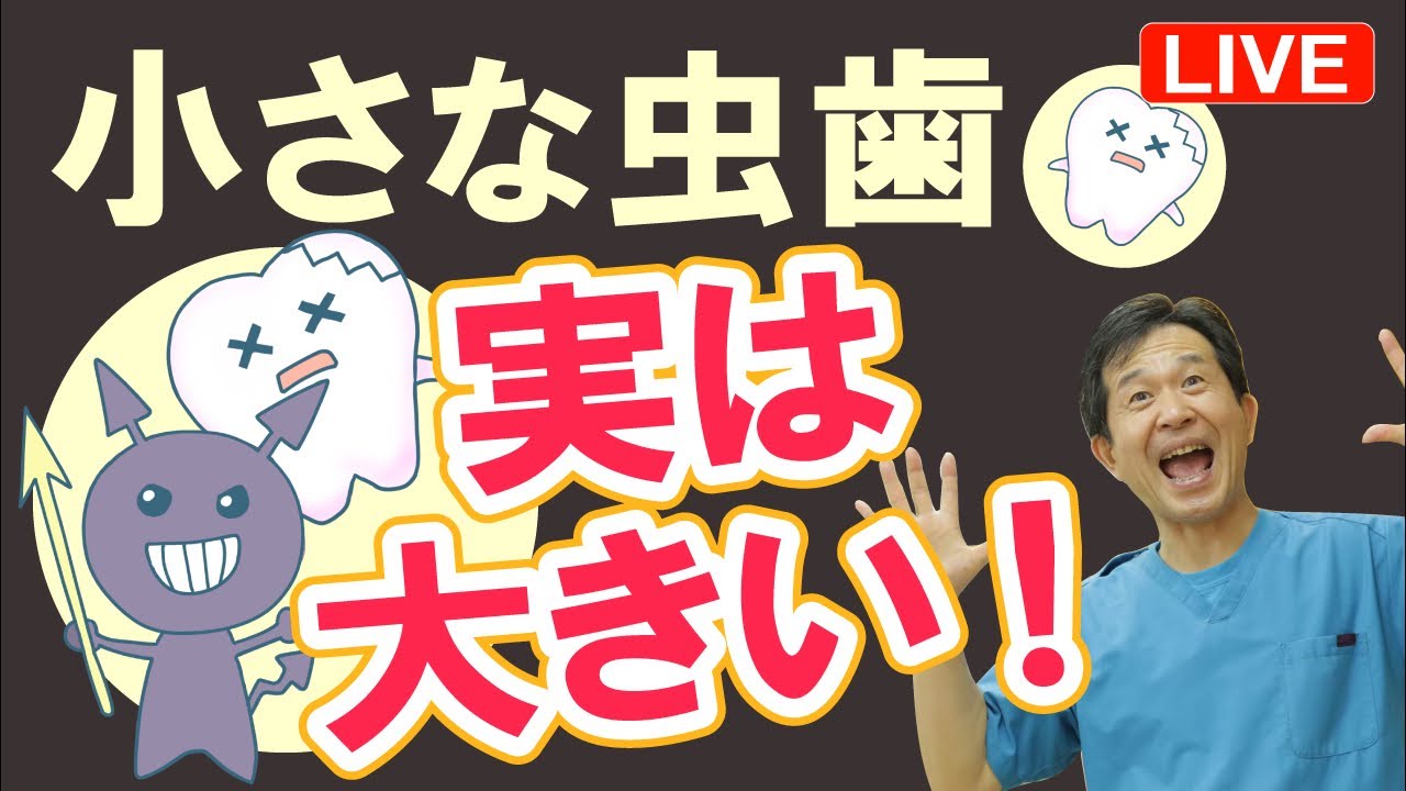 3/12(木)21:00夢デンLIVE「見た目小さなその虫歯、実は大きくて深い！？」虫歯は見た目で判断できない事を現役歯科医が詳しく解説