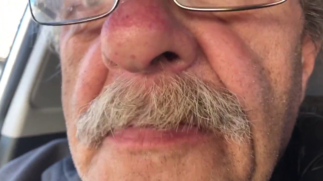 Smoking turns your mustache brown