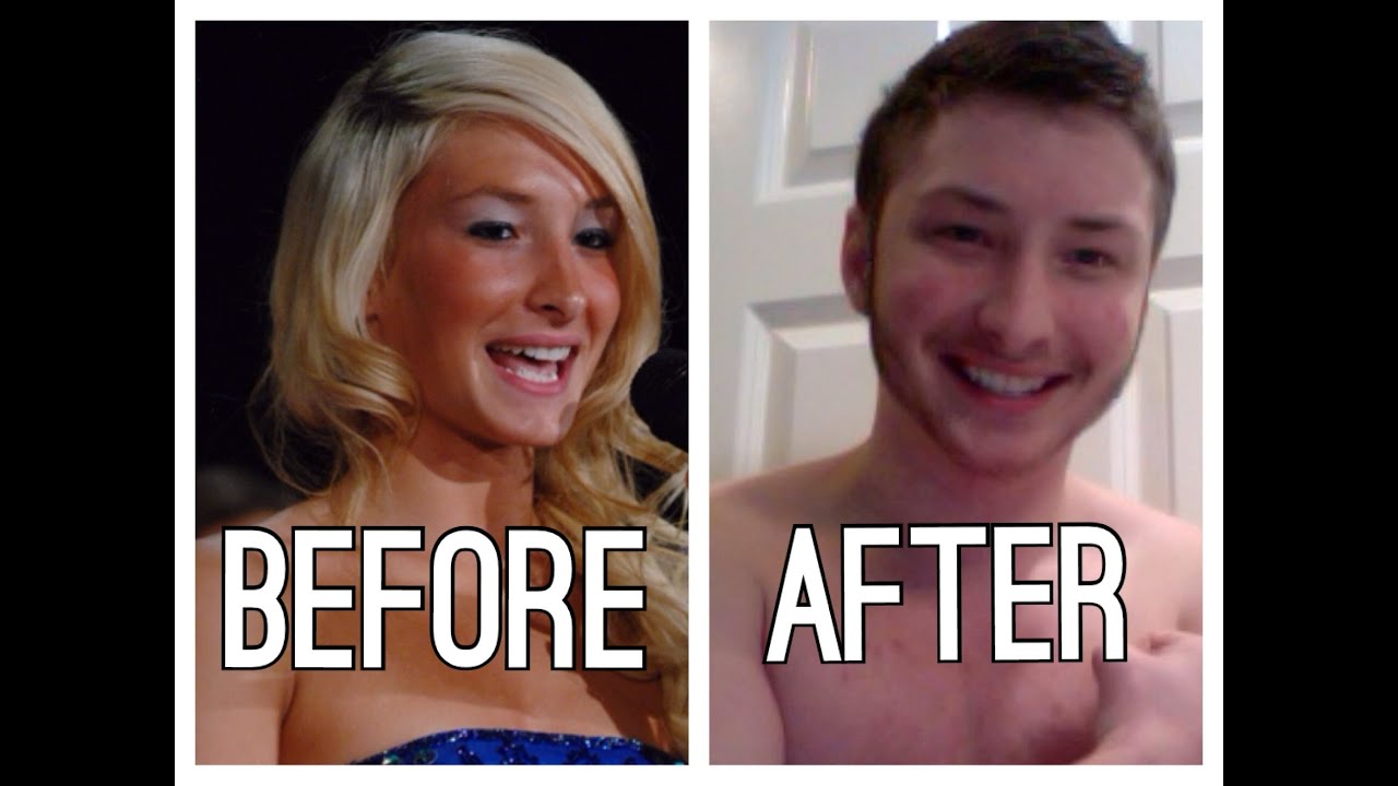 Female to Male: Pre transition to 18 Months on Testosterone | Ashton Colby
