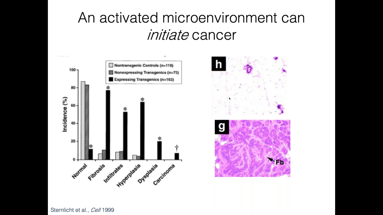 Metastatic Breast Cancer and The Tumor Microenvironment