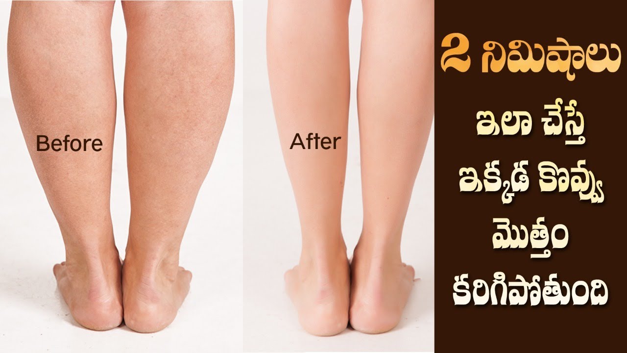 Best Exercises to Tone your Calves | Burns Fat | Slim Legs | Yoga with Dr.Tejaswini Manogna