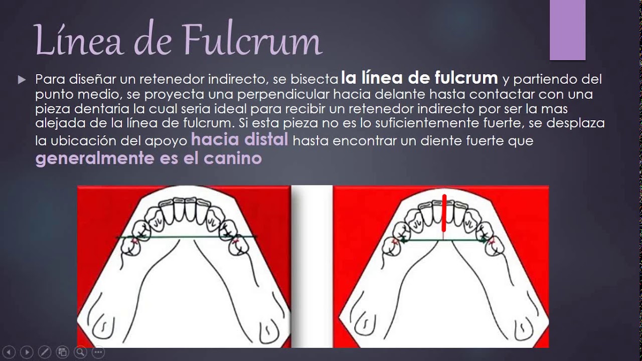 DISEÑO PPR (Primera Parte)
