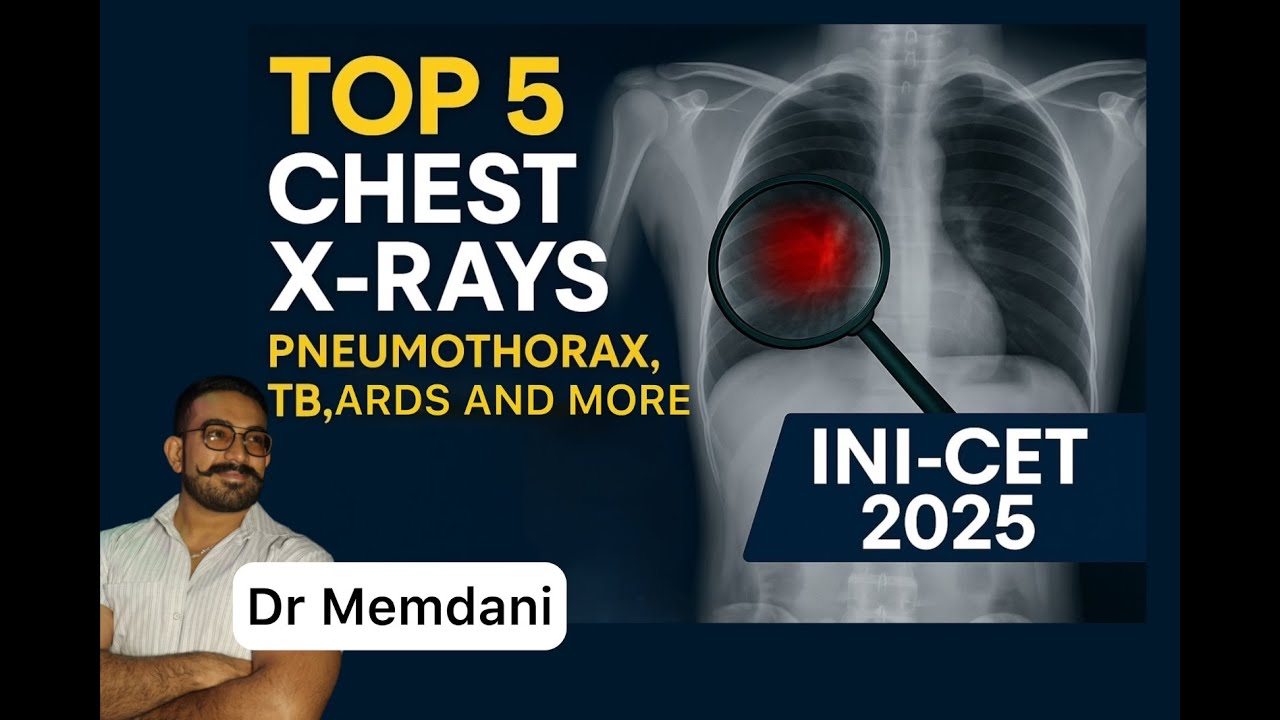 Top 5 Chest X-rays for INI-CET 2025 | Pneumothorax, TB, PE & More I Rapid Last minute Radio Review