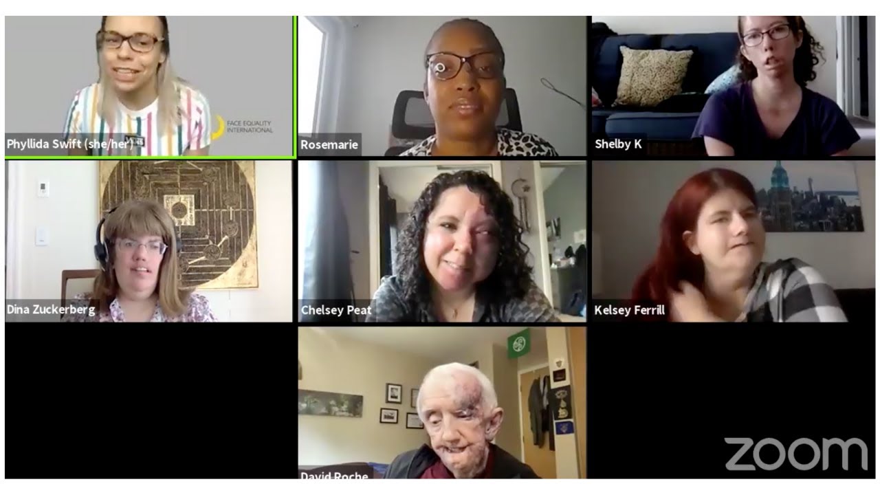 Moebius Syndrome Campaign | How to approach someone with a facial difference