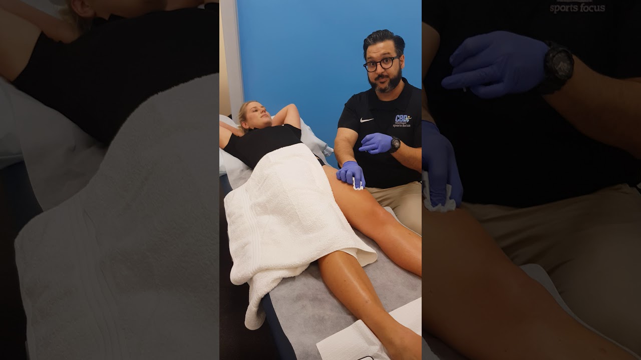 Trigger Point Dry Needling