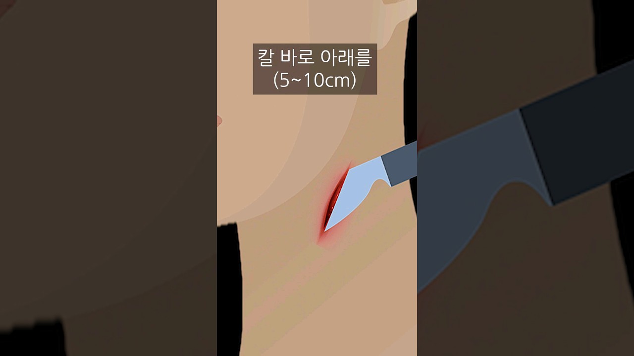 칼에 '목' 찔렸을 때 살아남는 방법 (한가지도 틀리지 마세요)