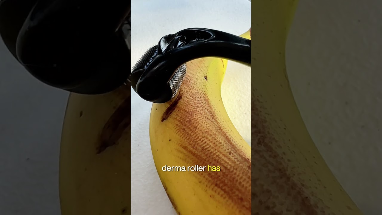 Real needles vs Fake needles Dermaroller