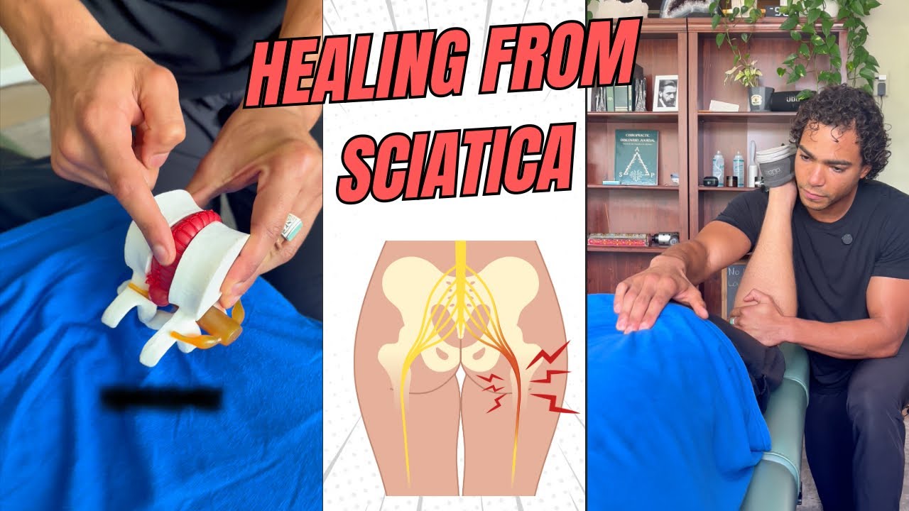 Healing from Sciatica | Chiropractic walk through 