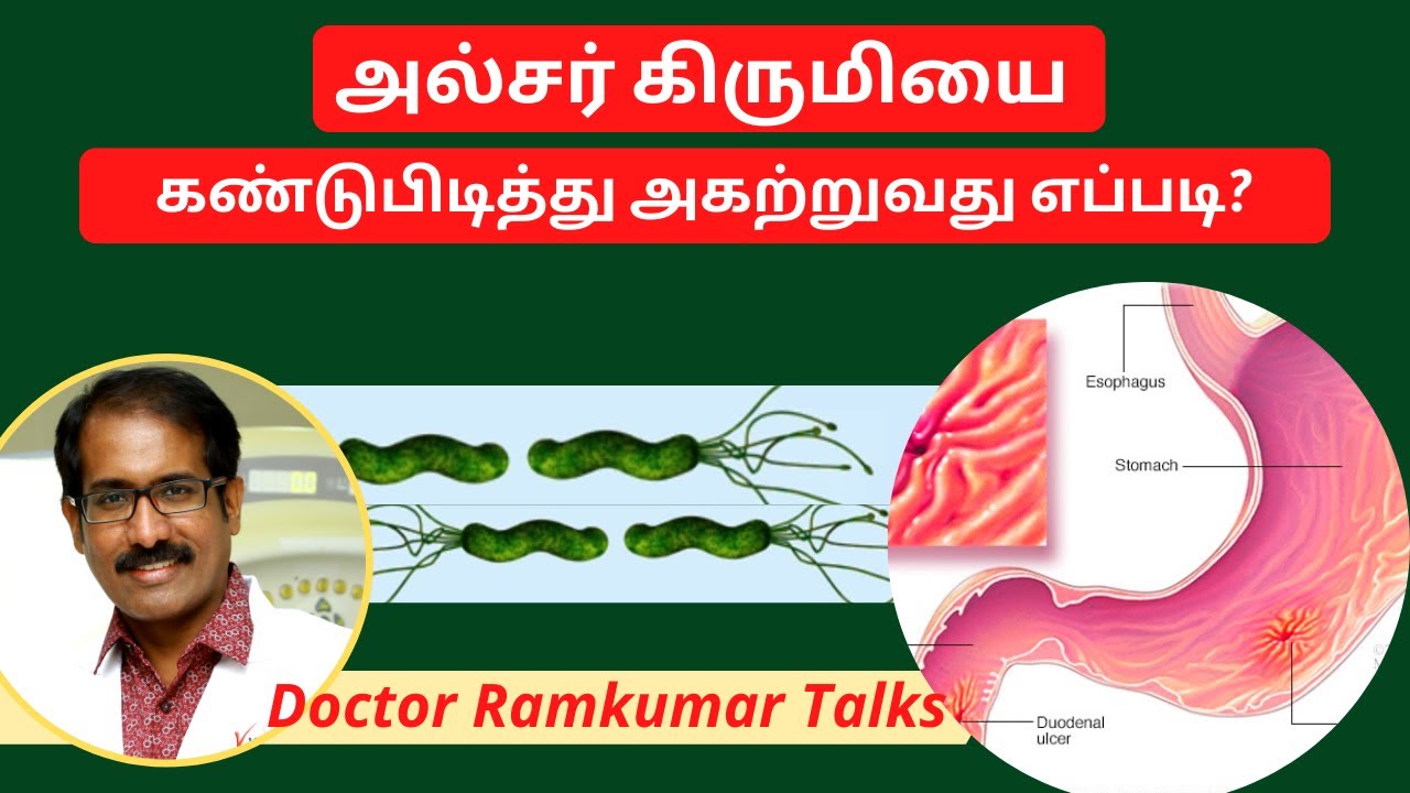 வயிற்றில் அல்சர் கிறுமி இருந்தால் கண்டுபிடிப்பது குணப்படுத்துவது எப்படி? அறிகுறிகள் என்ன? H Pylori 2