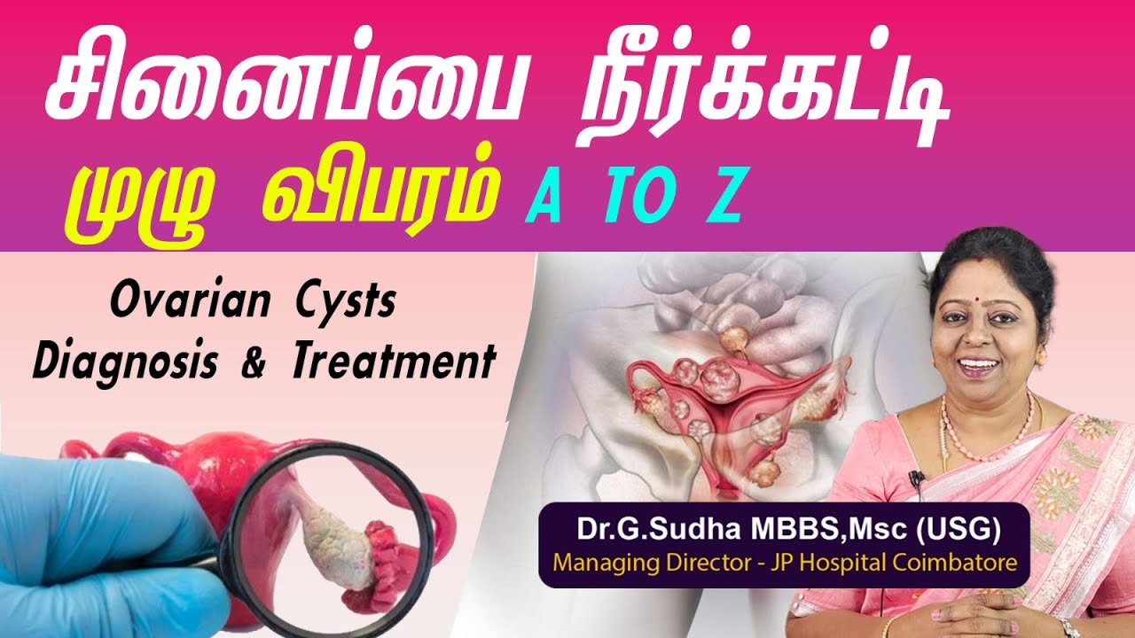 Ovarian Cysts Diagnosis & Treatment | சினைப்பை நீர்க்கட்டி   முழு விபரம் | Dr. G. Sudha