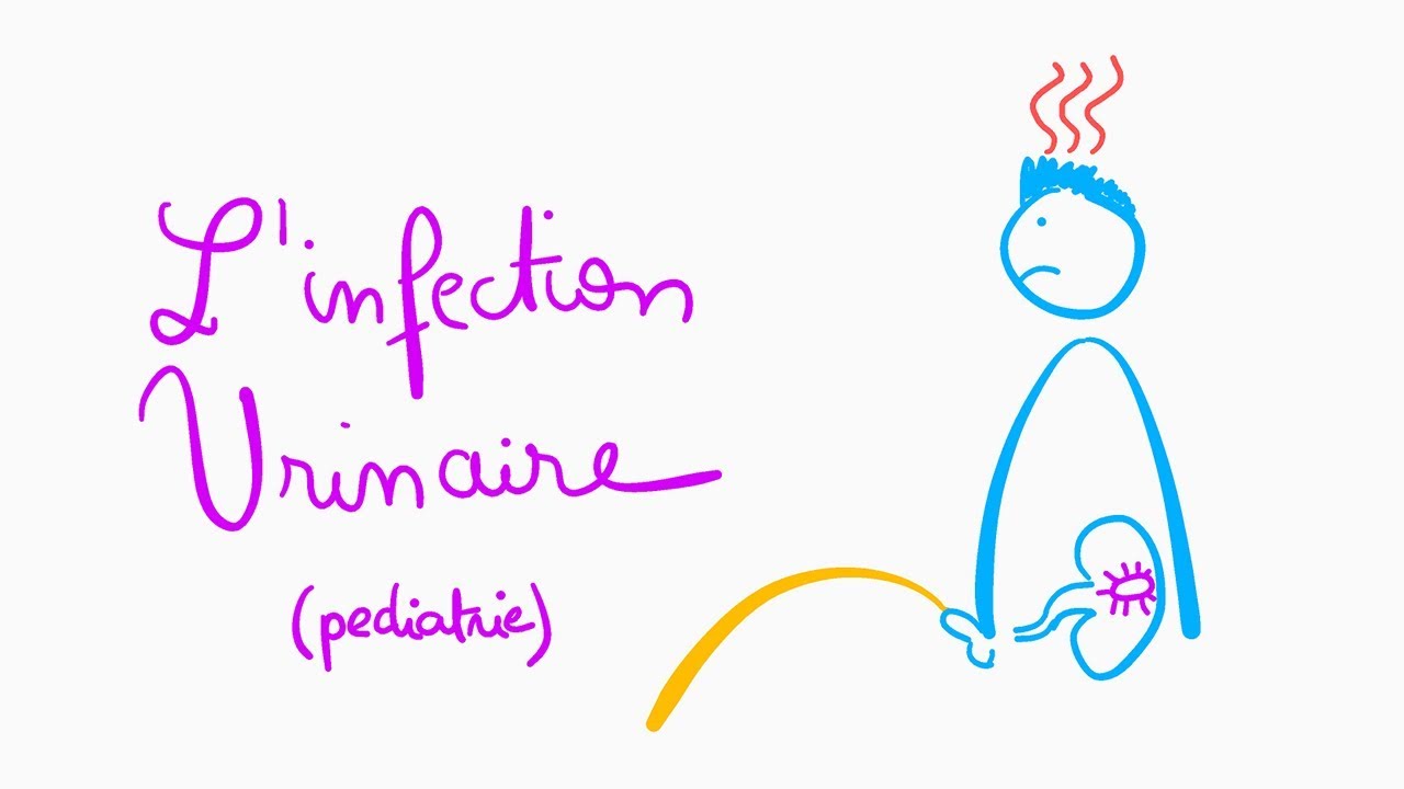 🔴 L'EXPLICATION LA PLUS CLAIRE DE L'INFECTION URINAIRE PEDIATRIQUE  !