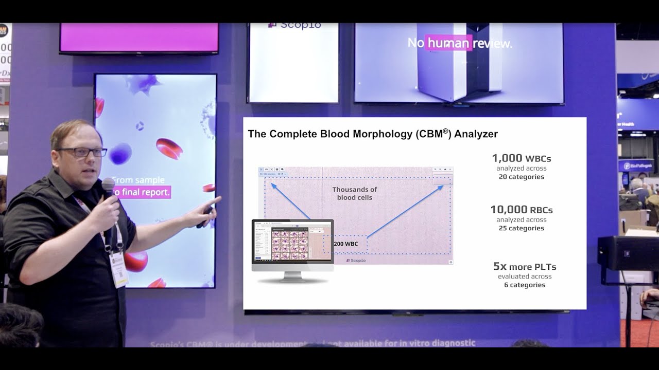Complete Blood Morphology (CBM): First Look at Fully Autonomous Digital Morphology | ADLM 2025