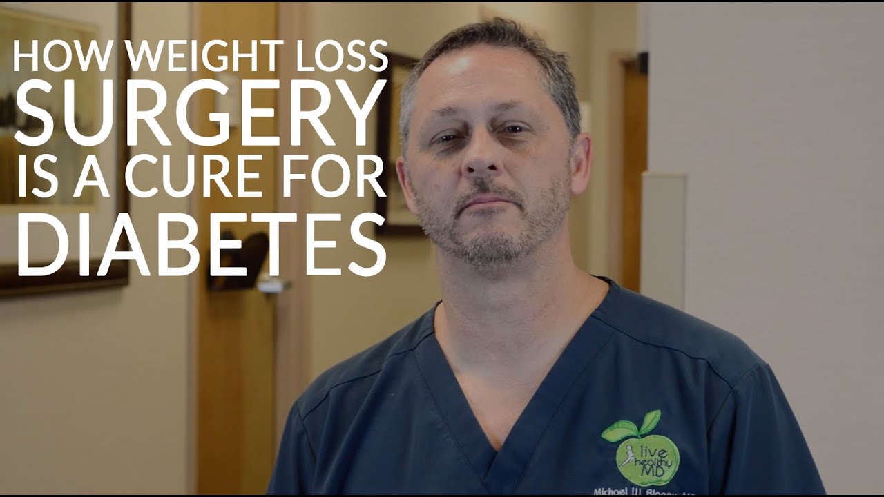 BARIATRIC SURGERY AND DIABETES | How Weight Loss Surgery is a Cure for Diabetes