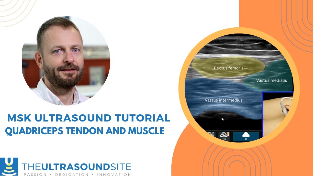 Step-by-step approach to the quadriceps tendon and muscle on ultrasound