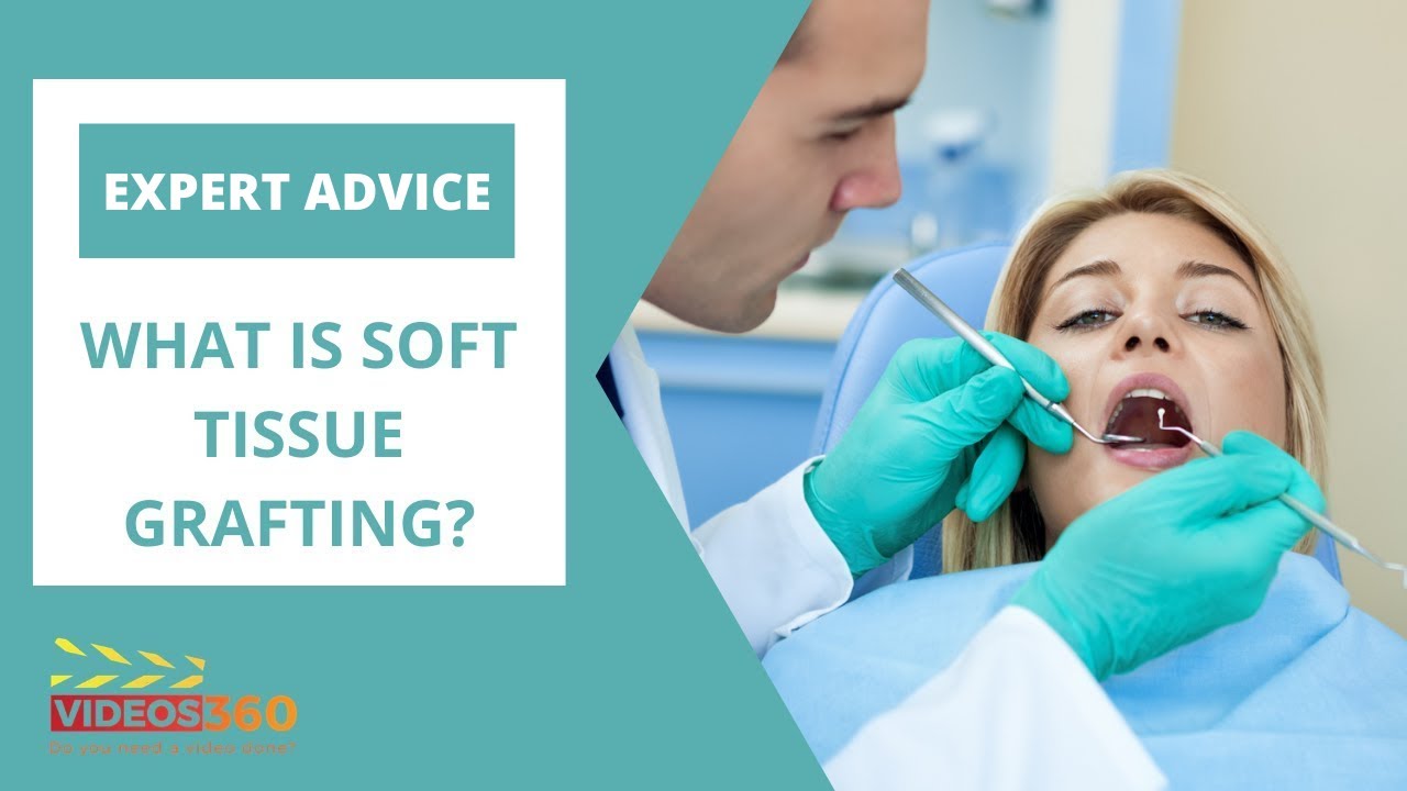 All about soft tissue grafting at Tansley Woods Dentistry explained by Dr. Thelam Nguyen