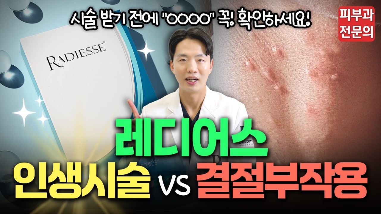 콜라겐 부스터 끝판왕 ‘레디어스’ 당신만 몰랐던 'OOOO'의 비밀 | 결절 부작용, 통증, 시술 후 관리법