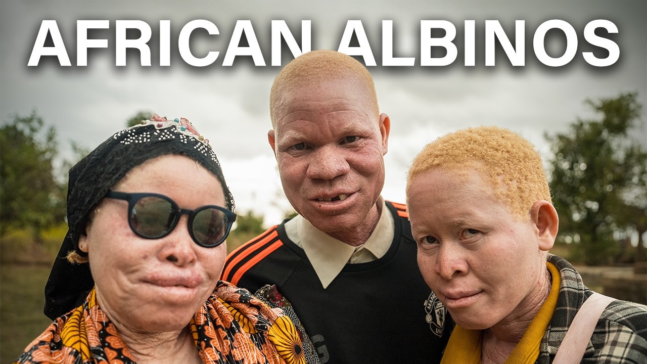 СЕКРЕТНЫЙ ОСТРОВ АФРИКАНСКИХ АЛЬБИНИ 🇹🇿