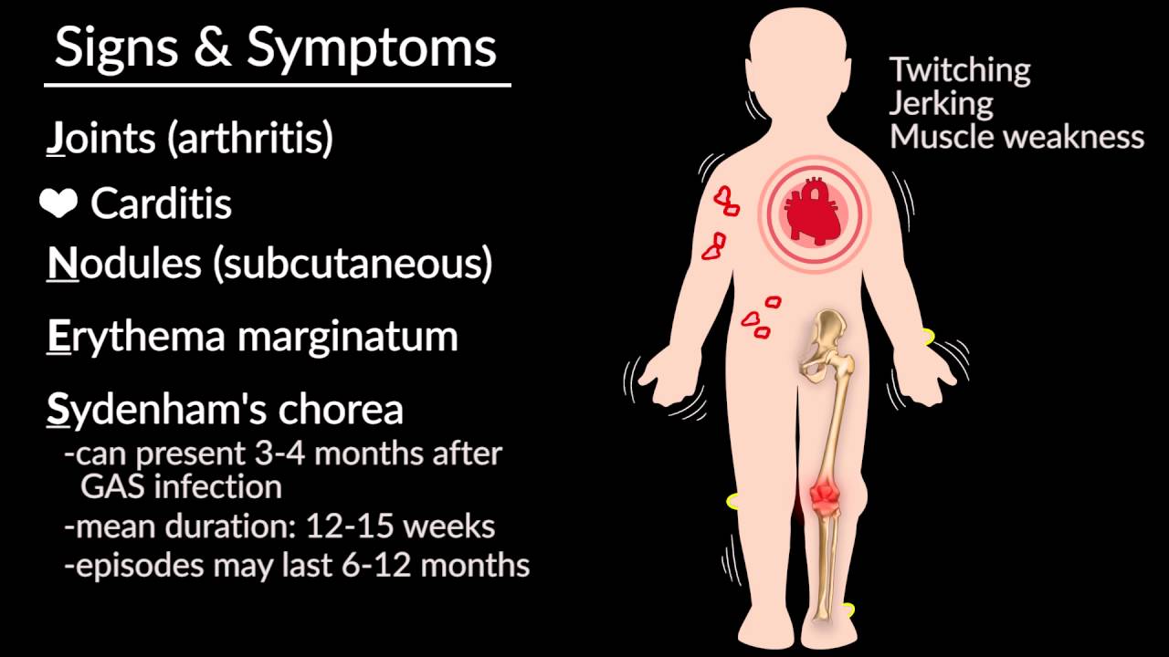Acute Rheumatic Fever by E. Rusingiza | OPENPediatrics